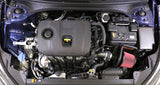 AEM C.A.S. 19-20 Kia Forte 2.0L F/I 21-858C