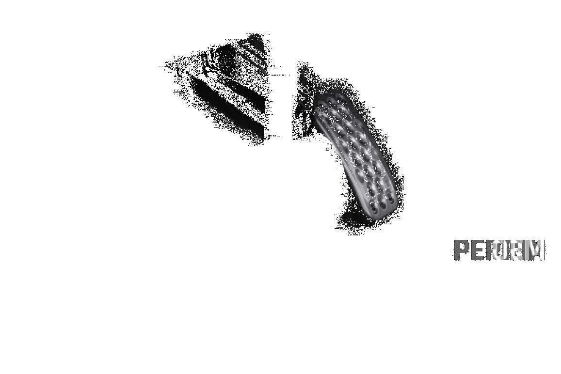 Perrin 17-19 Honda Civic Si / Type R Accelerator Pedal Relocate PHP-DRV-088